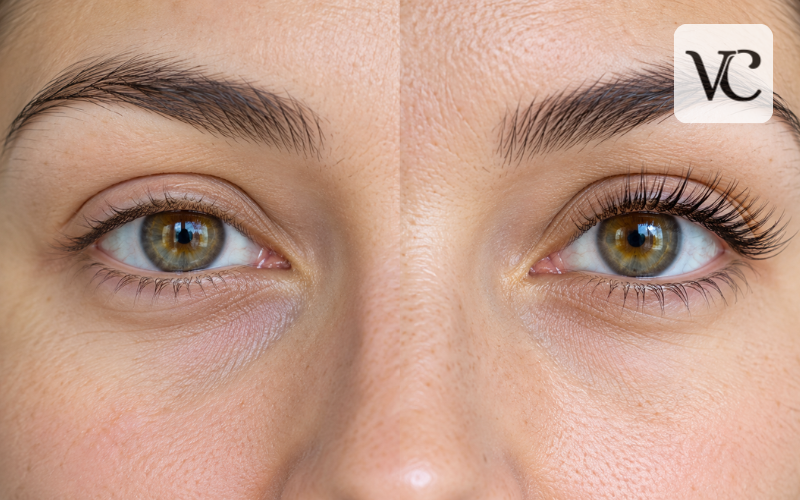 do eyelashes grow back
